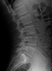 Radiographie bassin