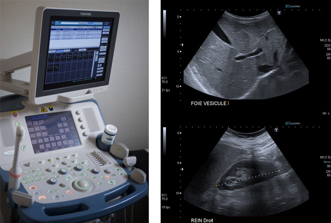 Échographie | Centre de radiologie Sud Rhône Imagerie