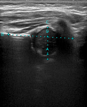 Radiopediatrie Centre De Radiologie Sud Rhone Imagerie