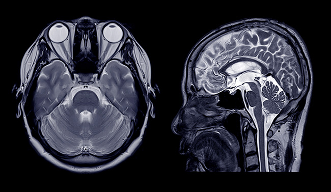 IRM | Centre de radiologie Sud Rhône Imagerie