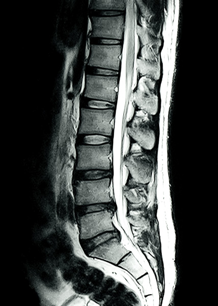 IRM | Centre de radiologie Sud Rhône Imagerie